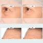 Dubbele behandeling met retinol en collageenpeptiden